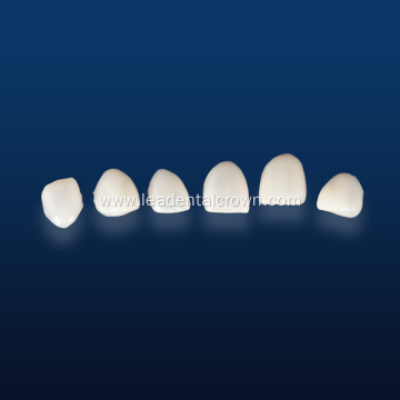 Advanced Lithium Disilicate Restorations with IPS Emax